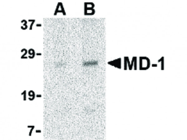 Anti-MD-1
