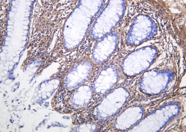 Anti-Recombinant Collagen VI, clone 7B3