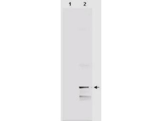 Anti-MIF (Macrophage migration inhibitory factor)