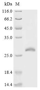 Ras-related protein Rab-15 (RAB15), recombinant human