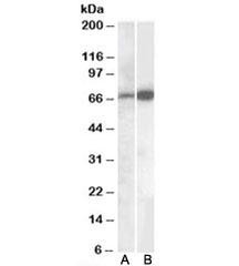 Anti-CADM4