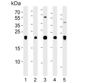 Anti-Inosine triphosphate pyrophosphatase / ITPA / ITPase