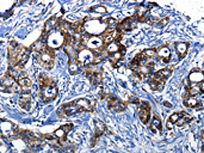 Anti-CASP1