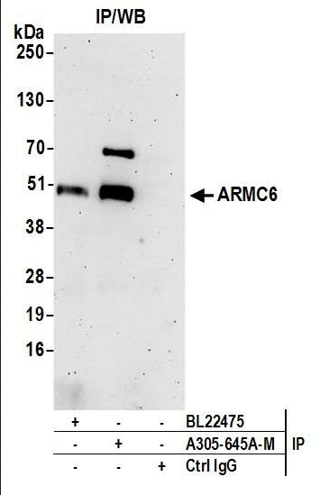Anti-ARMC6