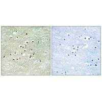 Anti-NPAS4