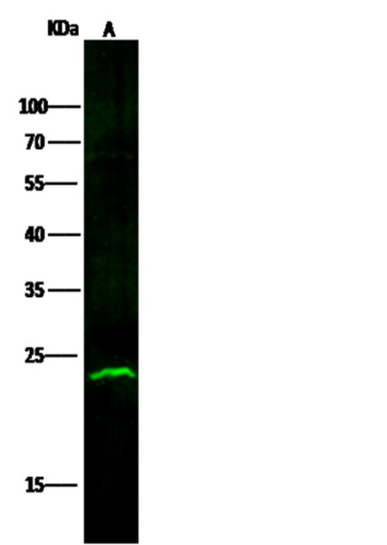 Anti-ABHD14B Monoclonal Recombinant Antibody