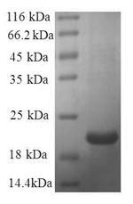 Galectin-7 (LGALS7), human, recombinant