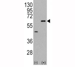 Anti-AKT3