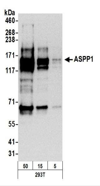 Anti-ASPP1