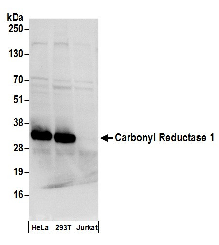 Anti-Carbonyl Reductase 1/CBR1