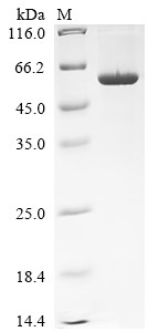 Interleukin-12 receptor subunit beta-1 (IL12RB1), partial, human, recombinant