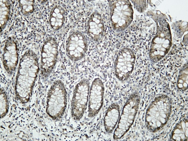 Anti-Recombinant Caspase-11, clone C512177