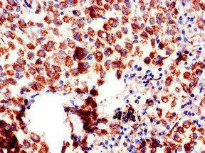 Anti-AQP6
