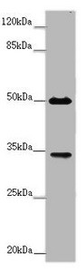 Anti-FCGR2B