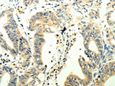 Anti-TRPM7