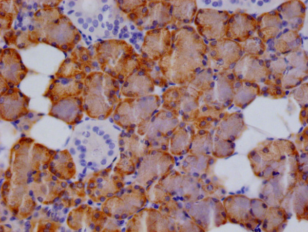 Anti-CTPS1 Recombinant Monoclonal, clone 13B6