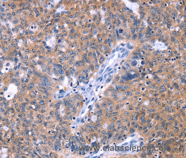 Anti-ZNF395