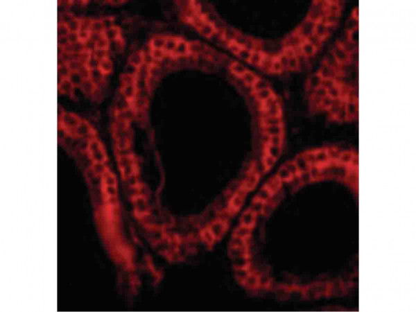 Anti-Bcl-G