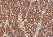 Anti-Vimentin/VIM Monoclonal Recombinant Antibody