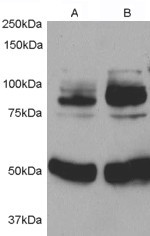 Anti-APPL1, Internal