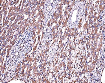 Anti-Alpha-2-Antiplasmin / SERPINF2