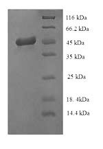 Intermediate capsid protein VP6, Rotavirus A, recombinant