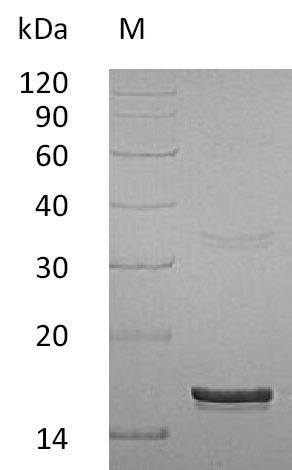 Interferon gamma (IFNG) (Active), human, recombinant