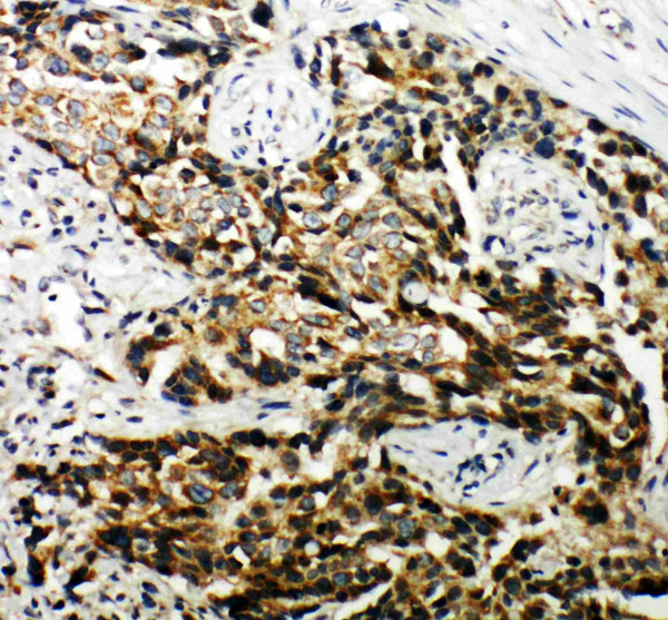 Anti-TSC1 / Hamartin