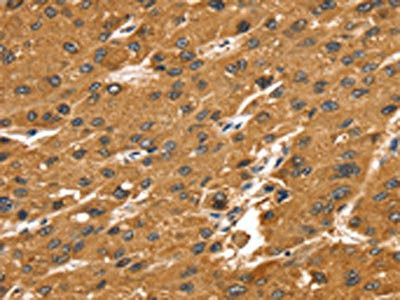 Anti-SRGAP1