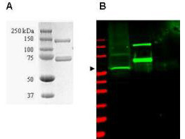 Anti-SUMO Activating Enzyme E1