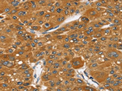 Anti-SRGAP1