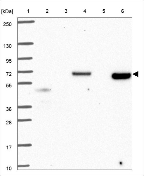 Anti-CORO1C