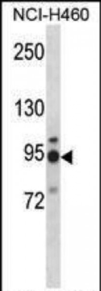 Anti-MGAT5, CT (MGAT5, GGNT5, Alpha-1,6-mannosylglycoprotein 6-beta-N-acetylglucosaminyltransferase