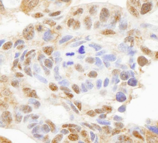 Anti-HDAC7 (IHC)