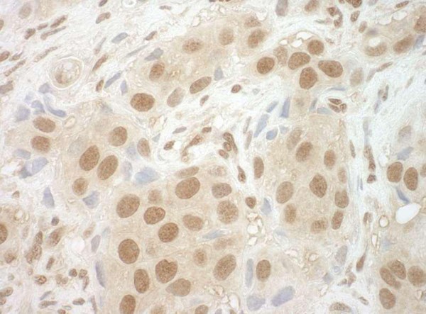 Anti-NCBP2 (IHC)