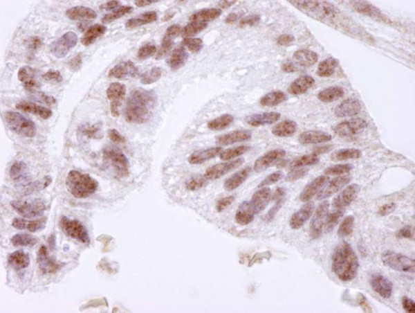 Anti-CTCF (IHC)