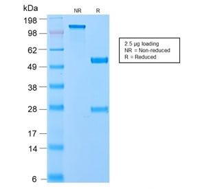 Anti-VLDLR / VLDL Receptor, clone VLDLR/2896R