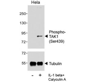 Anti-phospho-TAK1 (Ser439)