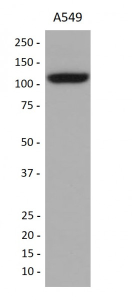 Anti-TRPM8