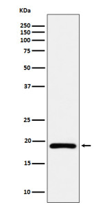 Anti-DUT / Deoxyuridine triphosphatase, clone 31D50