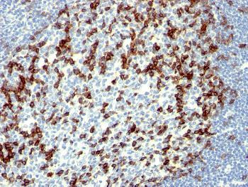 Anti-PDCD1 / PD1 / CD279 (Programmed Cell Death 1) Monoclonal Antibody (Clone: NAT105)