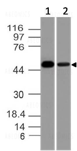 Anti-Tyrosine 3-monooxygenase (Clone: ABM51D7)