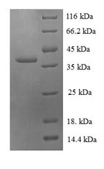 60S ribosomal protein L30 (RPL30), human, recombinant