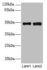 Anti-DBF4B