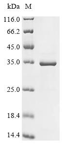 SUN domain-containing protein 3 (SUN3), partial, recombinant human
