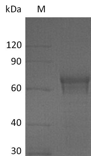Interleukin-15 receptor subunit alpha (IL15RA), partial (Active), human, recombinant