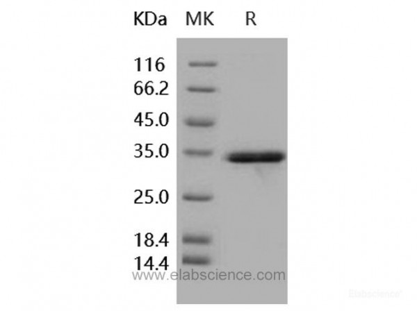 IL-1 beta / IL1B Protein (pro form, His tag) (recombinant human)