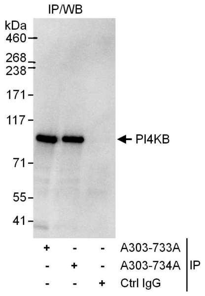 Anti-PI4KB