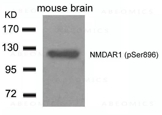 Anti-phospho-NMDAR1 (Ser896)