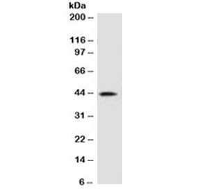 Anti-AMACR / p504S (Prostate Cancer Marker), clone 2MACR-1